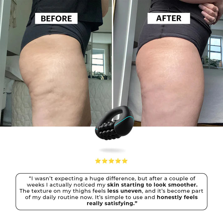 Anti-cellulitis lymfatische rolmassageapparaat