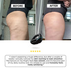 Anti-cellulitis lymfatische rolmassageapparaat