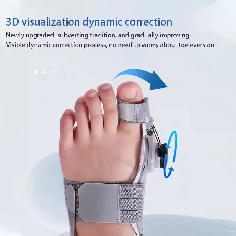 Bunion Corrector — Hallux Valgus Beugel