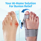 Bunion Corrector — Hallux Valgus Beugel
