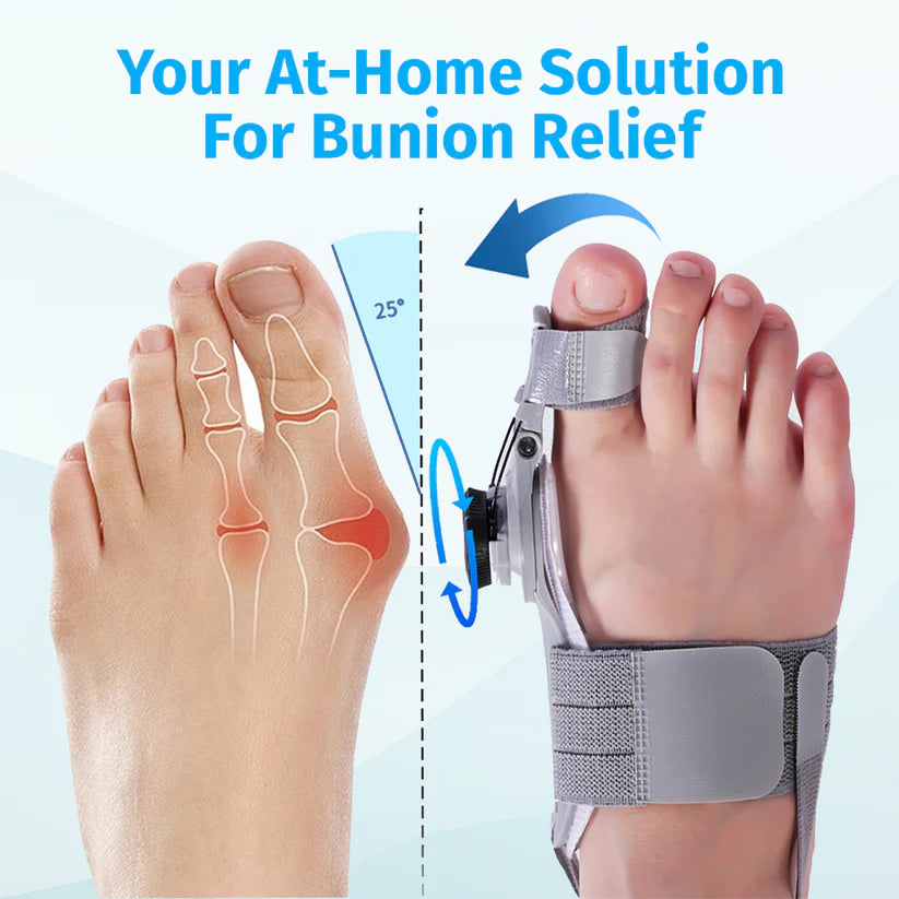 Bunion Corrector — Hallux Valgus Beugel