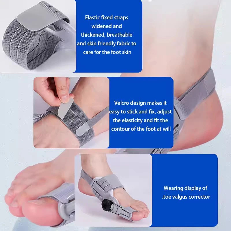 Bunion Corrector — Hallux Valgus Beugel